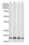 Ubiquitin Conjugating Enzyme E2 L3 antibody, orb18828, Biorbyt, Western Blot image 