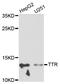 Transthyretin antibody, STJ25986, St John