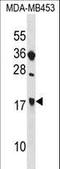 Signaling Threshold Regulating Transmembrane Adaptor 1 antibody, LS-C161106, Lifespan Biosciences, Western Blot image 