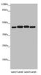 Pyruvate Dehydrogenase E1 Alpha 2 Subunit antibody, LS-C676236, Lifespan Biosciences, Western Blot image 
