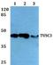 Tumor Suppressor Candidate 3 antibody, A05834-1, Boster Biological Technology, Western Blot image 