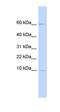 Peptidase Inhibitor 3 antibody, orb325211, Biorbyt, Western Blot image 