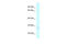 Charged multivesicular body protein 2a antibody, ARP62112_P050, Aviva Systems Biology, Western Blot image 