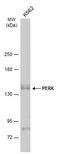 Eukaryotic Translation Initiation Factor 2 Alpha Kinase 3 antibody, GTX129275, GeneTex, Western Blot image 