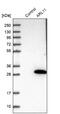 ADP Ribosylation Factor Like GTPase 11 antibody, NBP1-88989, Novus Biologicals, Western Blot image 
