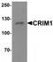 Cysteine Rich Transmembrane BMP Regulator 1 antibody, TA319917, Origene, Western Blot image 