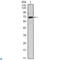 Protein Tyrosine Kinase 2 antibody, LS-C812598, Lifespan Biosciences, Western Blot image 
