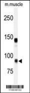 ADAM Metallopeptidase With Thrombospondin Type 1 Motif 5 antibody, 62-915, ProSci, Western Blot image 