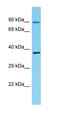 Olfactory Receptor Family 4 Subfamily F Member 3 antibody, orb327177, Biorbyt, Western Blot image 