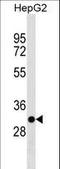 T Cell-Interacting, Activating Receptor On Myeloid Cells 1 antibody, LS-C157135, Lifespan Biosciences, Western Blot image 