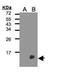 TYRO Protein Tyrosine Kinase Binding Protein antibody, PA5-28803, Invitrogen Antibodies, Western Blot image 