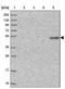 Mitochondrial Elongation Factor 2 antibody, NBP1-81165, Novus Biologicals, Western Blot image 