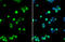 Transmembrane Protein 173 antibody, GTX134373, GeneTex, Immunofluorescence image 