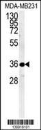 Myozenin-1 antibody, MBS9204056, MyBioSource, Western Blot image 