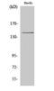 Mitogen-Activated Protein Kinase Kinase Kinase Kinase 4 antibody, STJ93495, St John