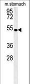 Coronin 6 antibody, LS-C166957, Lifespan Biosciences, Western Blot image 