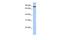 Transmembrane And Tetratricopeptide Repeat Containing 1 antibody, GTX46122, GeneTex, Western Blot image 