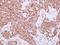 Cyclin A2 antibody, PA5-27837, Invitrogen Antibodies, Immunohistochemistry paraffin image 