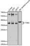 Transducer Of ERBB2, 2 antibody, A7223, ABclonal Technology, Western Blot image 