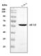 Hexosaminidase Subunit Beta antibody, PB9211, Boster Biological Technology, Western Blot image 