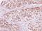 Protein Serine Kinase H1 antibody, GTX103525, GeneTex, Immunohistochemistry paraffin image 