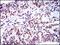BMI1 Proto-Oncogene, Polycomb Ring Finger antibody, NBP2-22204, Novus Biologicals, Immunohistochemistry frozen image 