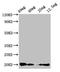 S100 Calcium Binding Protein A12 antibody, orb47895, Biorbyt, Western Blot image 