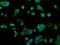 Alcohol dehydrogenase [NADP+] antibody, NBP2-02164, Novus Biologicals, Immunocytochemistry image 