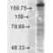 Glutamate Ionotropic Receptor NMDA Type Subunit 2B antibody, 56461, QED Bioscience, Western Blot image 