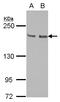 Kinesin Family Member 14 antibody, LS-C155210, Lifespan Biosciences, Western Blot image 