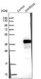 Ankyrin Repeat Domain 45 antibody, NBP1-85422, Novus Biologicals, Western Blot image 