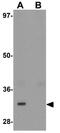 TRNA-YW Synthesizing Protein 3 Homolog antibody, GTX32016, GeneTex, Western Blot image 