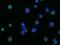 C-X-C Motif Chemokine Receptor 5 antibody, MAB6198, R&D Systems, Immunocytochemistry image 