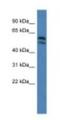 Lysophosphatidylcholine Acyltransferase 2 antibody, NBP1-79205, Novus Biologicals, Western Blot image 