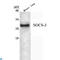Suppressor Of Cytokine Signaling 3 antibody, LS-C813125, Lifespan Biosciences, Western Blot image 