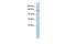 Transmembrane Protein 132B antibody, GTX45896, GeneTex, Western Blot image 