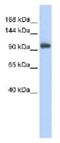 Ring Finger Protein 31 antibody, ab85294, Abcam, Western Blot image 