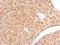 Amphiphysin antibody, LS-C185530, Lifespan Biosciences, Immunohistochemistry frozen image 