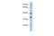 Testis Expressed 264, ER-Phagy Receptor antibody, GTX46351, GeneTex, Western Blot image 