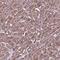 Cytosolic phospholipase A2 gamma antibody, PA5-60231, Invitrogen Antibodies, Immunohistochemistry paraffin image 