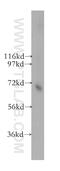 Transketolase antibody, 11039-1-AP, Proteintech Group, Western Blot image 