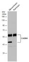 CADM4 antibody, GTX133294, GeneTex, Western Blot image 