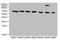 Transient Receptor Potential Cation Channel Subfamily M Member 2 antibody, orb23858, Biorbyt, Western Blot image 