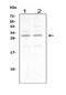 Ciliary Neurotrophic Factor antibody, PB9032, Boster Biological Technology, Western Blot image 