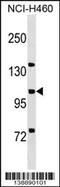 MCF.2 Cell Line Derived Transforming Sequence Like antibody, 60-130, ProSci, Western Blot image 