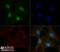 Tumor Protein P53 Binding Protein 1 antibody, NBP2-54753, Novus Biologicals, Immunofluorescence image 