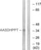 L-aminoadipate-semialdehyde dehydrogenase-phosphopantetheinyl transferase antibody, abx014546, Abbexa, Western Blot image 