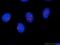 RLP24 antibody, 25190-1-AP, Proteintech Group, Immunofluorescence image 