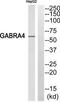 Gamma-Aminobutyric Acid Type A Receptor Alpha4 Subunit antibody, TA313904, Origene, Western Blot image 