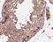 Methyltransferase Like 4 antibody, FNab05140, FineTest, Immunohistochemistry paraffin image 
